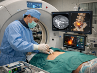 A photorealistic illustration depicting a CT-guided percutaneous ablation procedure for an iliac bone metastasis. An interventional radiologist wearing surgical attire is shown precisely inserting an ablation probe into the iliac bone under CT guidance, with real-time axial CT images and three-dimensional bone reconstruction displayed on adjacent monitors, highlighting image-guided tumor ablation in interventional oncology.
Prompt: "A doctor wearing a surgical gown is performing a CT-guided percutaneous ablation of an iliac bone metastasis in a patient. The image is generated in a photorealistic or high-quality 3D style, with an aspect ratio of 4:3 and a resolution of 1000 × 750 pixels."
Generator: DALL-E Feb 8 2026; Requestor: Dr. Yuan Huang. Source: Generated using DALL-E (OpenAI; Copyright: N/A (AI-Generated image); URL: https://cancer.jmir.org/2026/1/e86301; License: Public Domain (CC0).