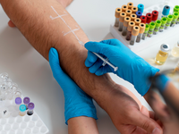 Source: Magnific; Copyright: freepik; URL: https://www.magnific.com/free-photo/skin-allergy-reaction-test-arm_19672636.htm; License: Licensed by JMIR.